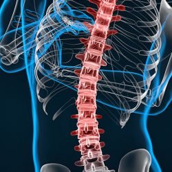 Spine image for scoliosis treatment in Singapore